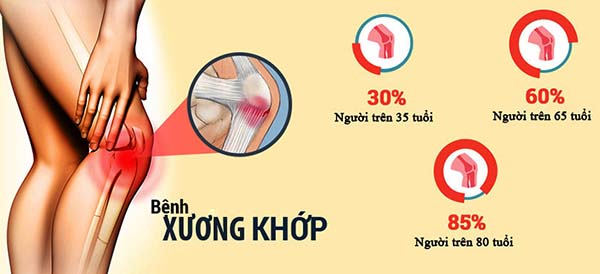 Ghế massage shika sk - 113 nâu trị liệu đau nhức xương khớp hiệu quả 3 