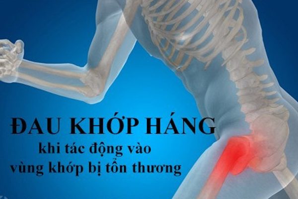 Trieu chung viem khop hang