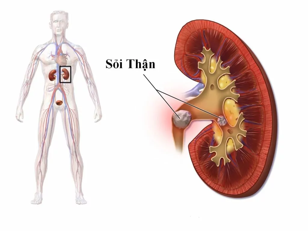 dau ha suon phai lan ra sau lung la do than min 1