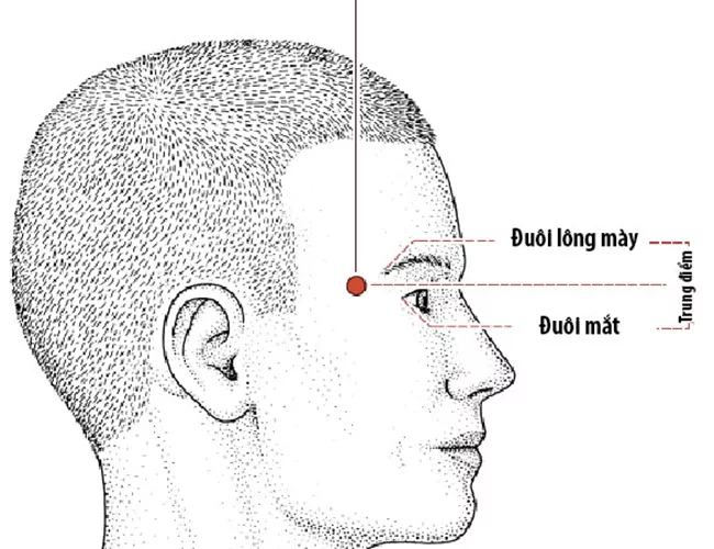 đau huyệt thái dương là bệnh gì ?