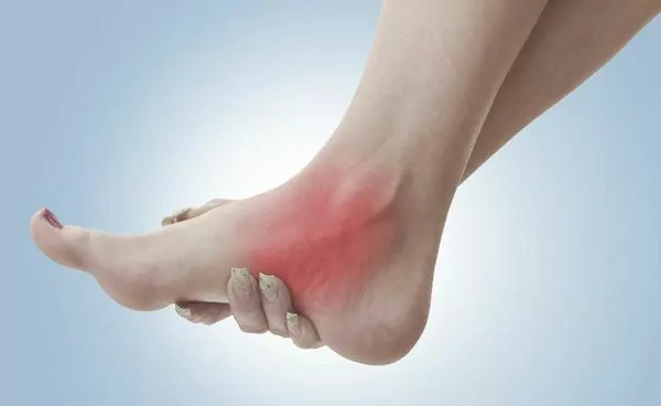 Triệu chứng của bệnh đau nhức chân có biểu hiện  như thế nào?