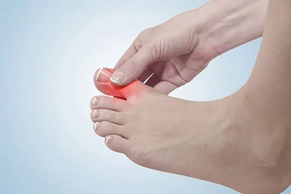 Bị tê ngón chân cái là bệnh gì?